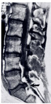 rmn-colonna1