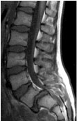rmn-colonna2