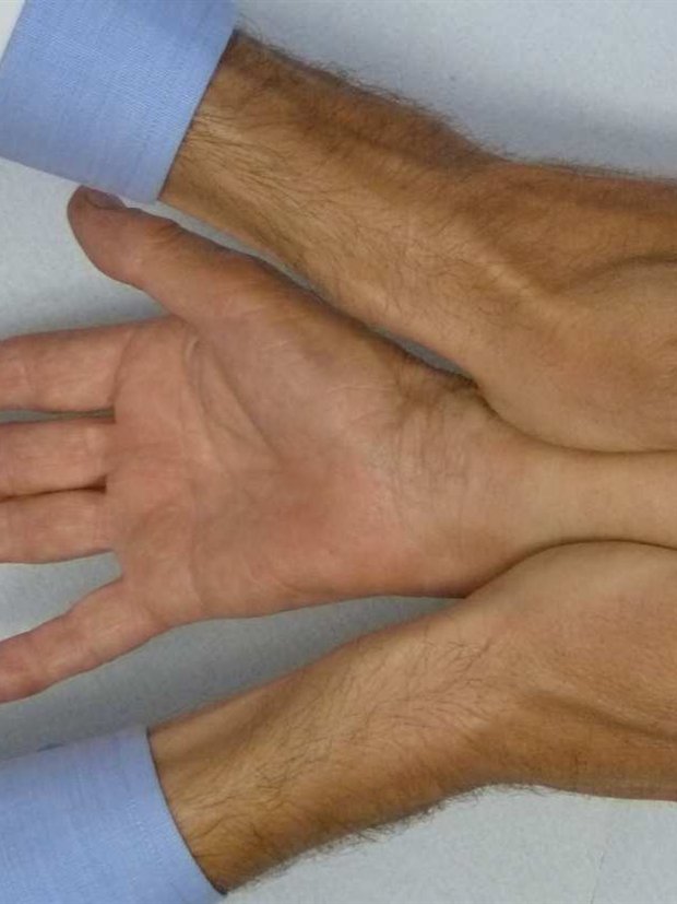 Valutazione della mano e del polso, palmo in alto